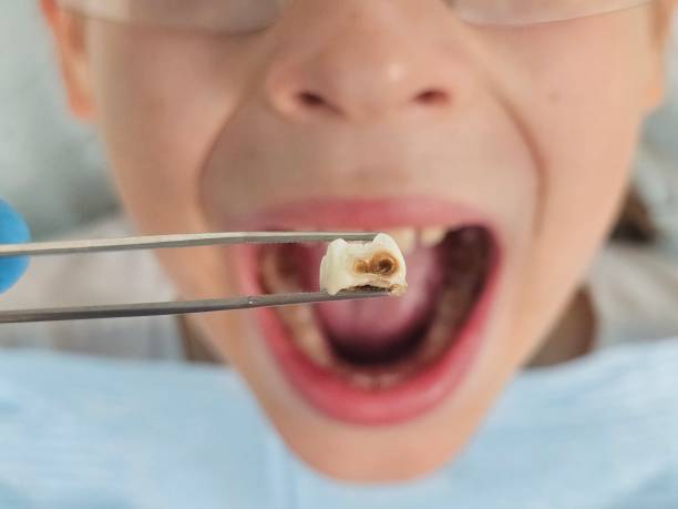 Best Pediatric Emergency Dentist in Hurricane, WV